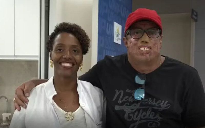 Ronaldo, portador de xeroderma pigmentoso, já passou por 230 cirurgias. Conheça sua história e a luta por qualidade de vida. | (Instituto Mais Identidade/Divulgação)