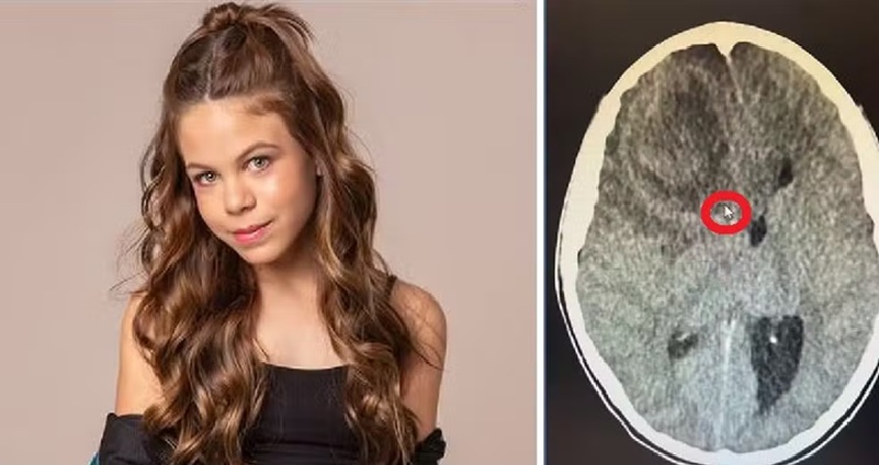 Millena Brandão tinha 11 anos; ao lado foto do exame onde seta do mouse circundada em vermelho mostra mancha suspeita de ser um tumor no cérebro da atriz, segundo a família — Foto: Reprodução/Divulgação 
