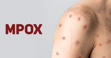 mpox (2)