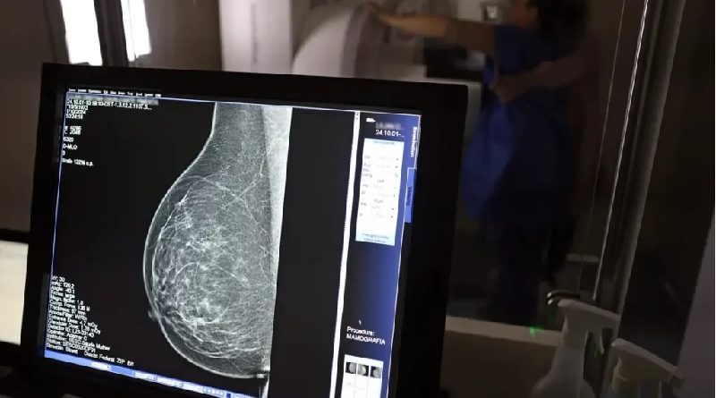 mamografia