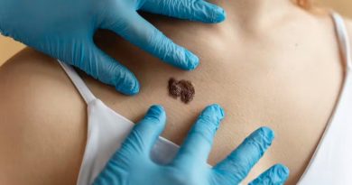 IA revoluciona diagnóstico de câncer de pele com com 95% de precisão