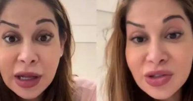 Maíra Cardi exibe rosto deformado após botox dar errado: ‘Olha que palhaçada’